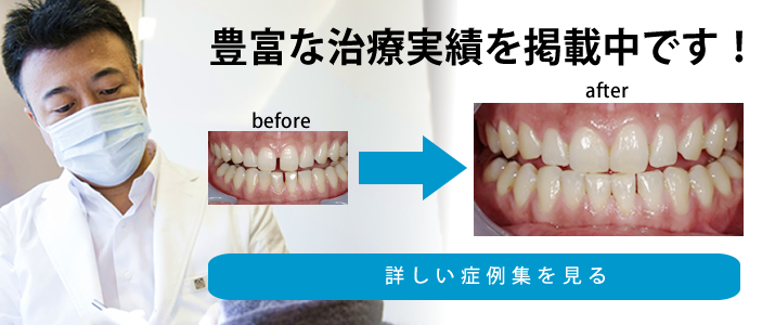 豊富な治療実績を掲載中です