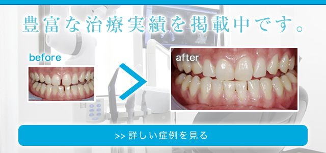 豊富な治療実績を掲載中です